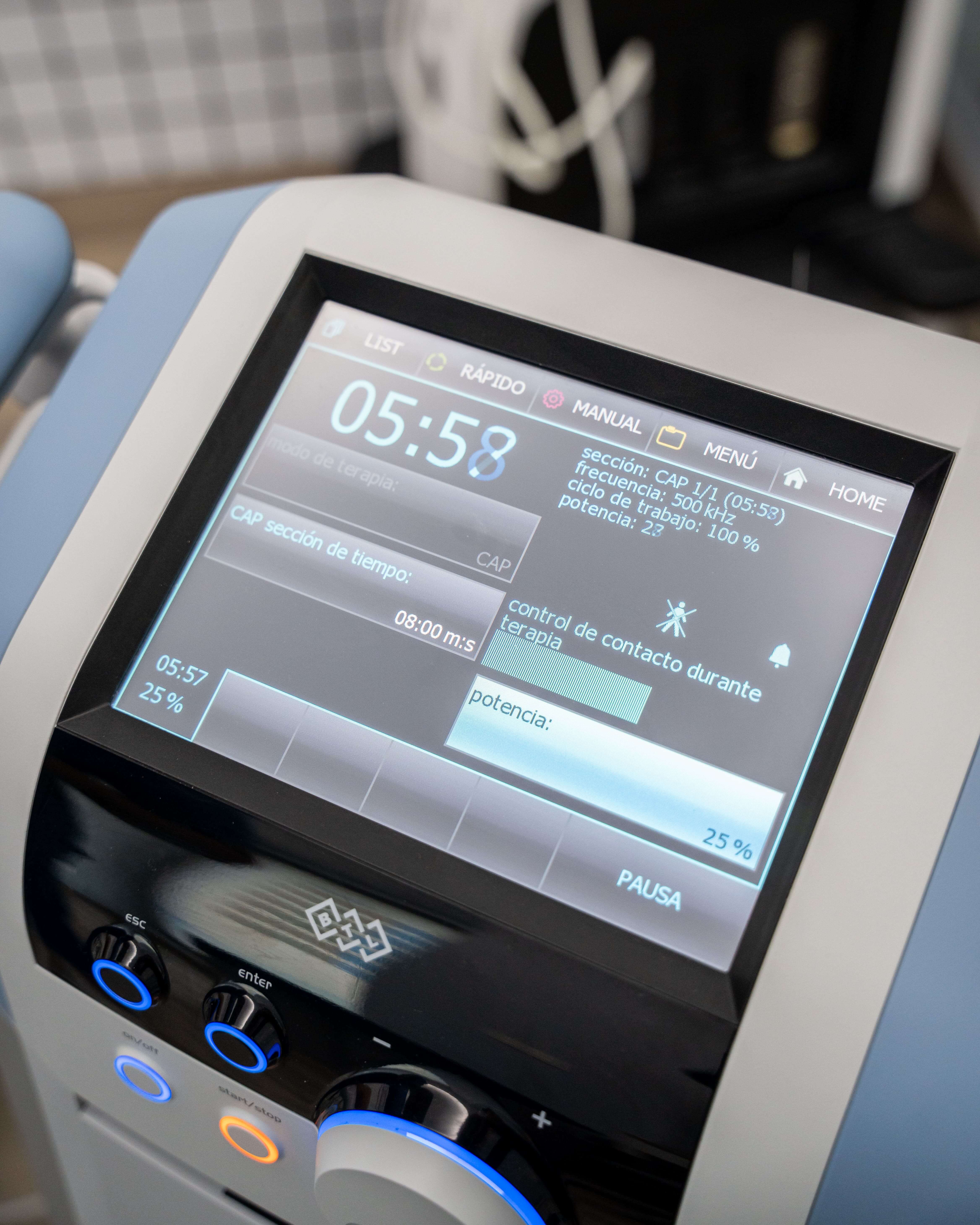 Aplicación de diatermia o radiofrecuencia TR en FisioSinergia Málaga