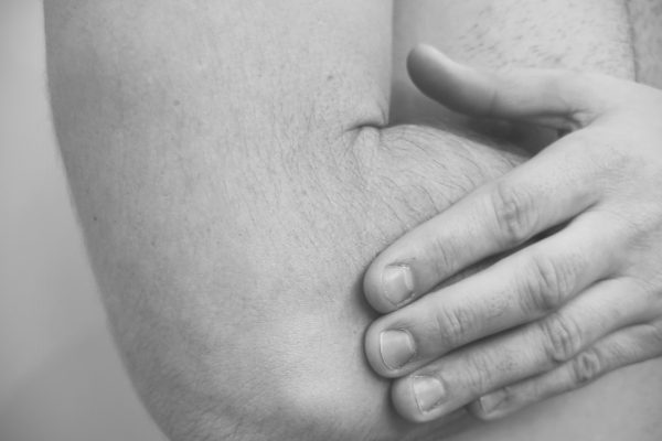 BLOG epicondilalgia
