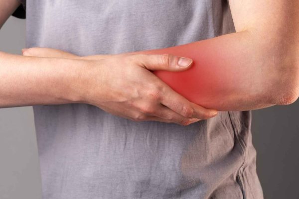 Contusión muscular - Sinergia Fisioterapia Especializada Málaga