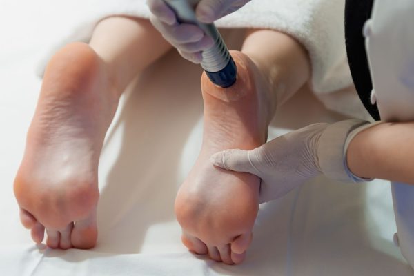 Ondas de choque focales Málaga- Clínica de Fisioterapia en Teatinos - Málaga