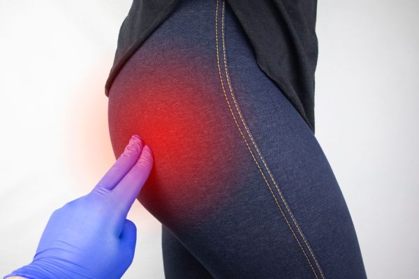 Síndrome Piramidal - Sinergia Fisioterapia Especializada Málaga