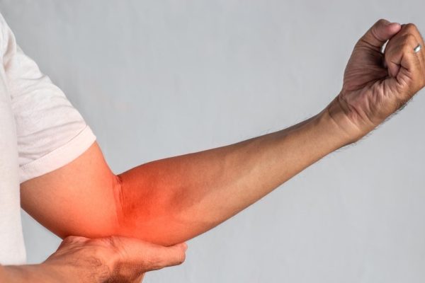 Tendinitis del brazo - Clínica de Fisioterapia en Teatinos - Málaga